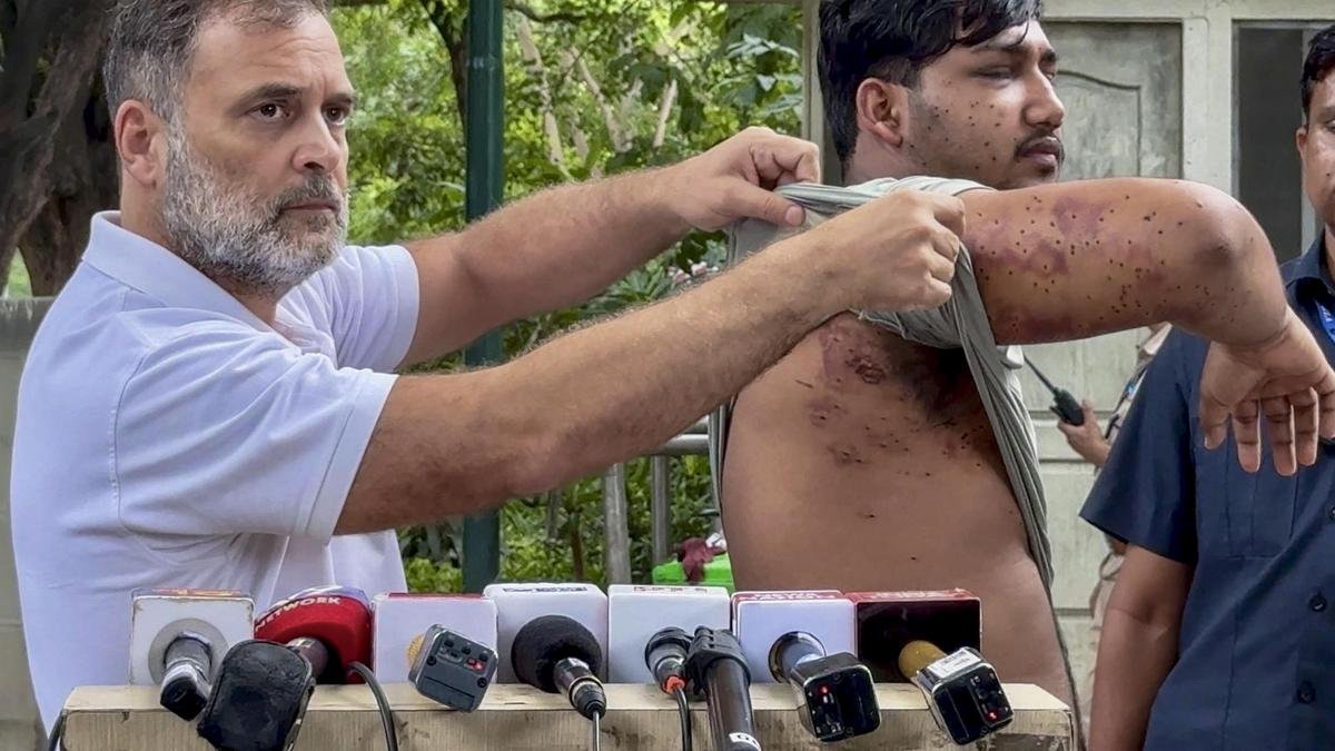 Centre lying on pellet gun use against protesters, says Rahul Gandhi