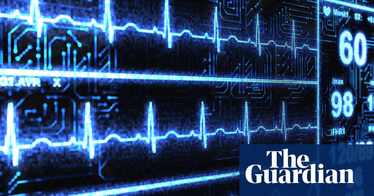 ‘Superhuman’ AI tool spots heart disease in less than 2 seconds
