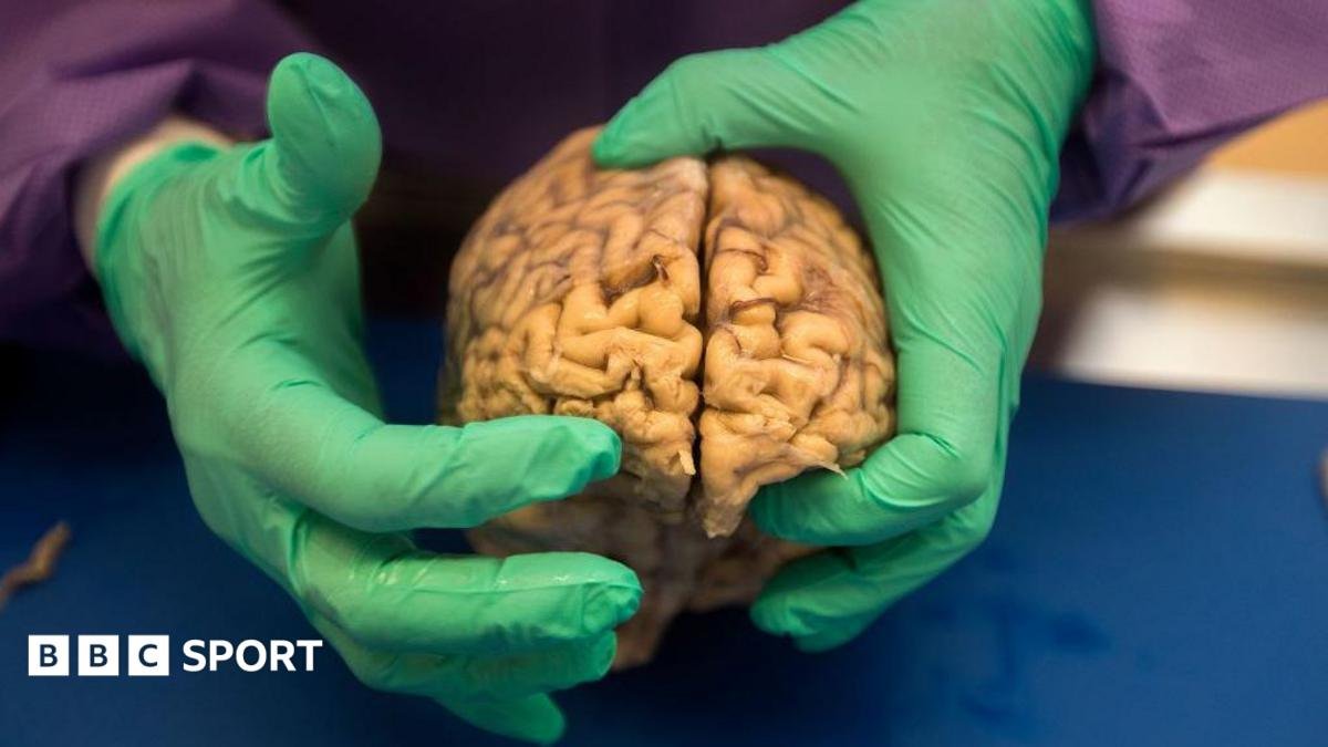 Brain disease in ex-NFL players 'higher than previously shown'