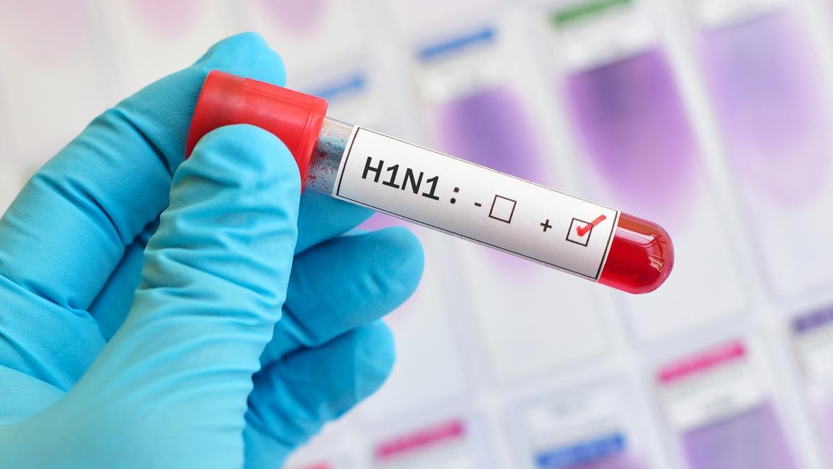 Jharkhand health department sounds alert after 8 persons tested positive for swine flu