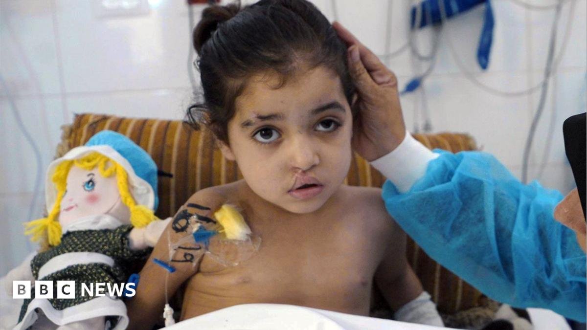 Girl has multiple surgeries to control infections after strike in Gaza