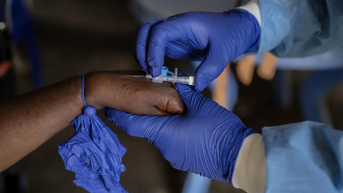 Mpox case confirmed in northeastern Congolese city at center of Ebola outbreak