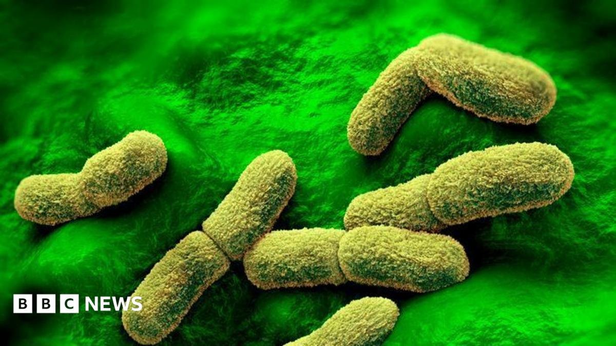 US 'watching closely' after plague researcher dies in Russia