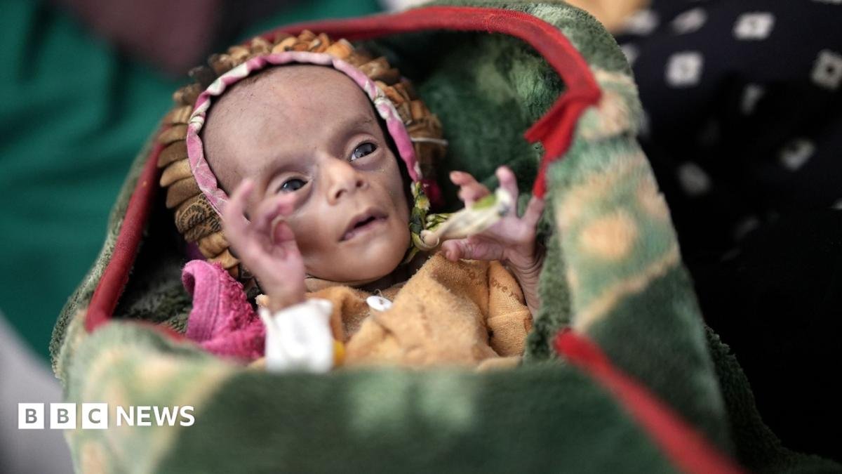 Newborn twins fight for survival as conflict fuels Yemen's hunger crisis